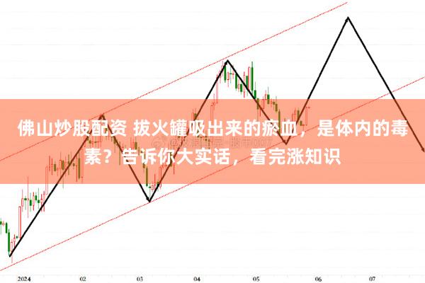 佛山炒股配资 拔火罐吸出来的瘀血，是体内的毒素？告诉你大实话，看完涨知识